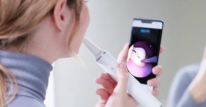Xiaomi SUNUO T11 Pro: ультразвуковой очиститель зубов